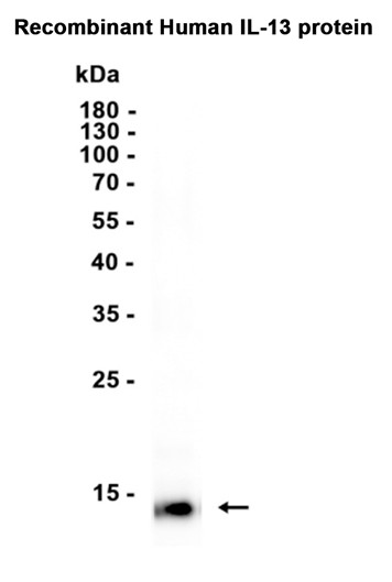 AYD15528