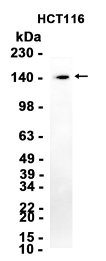 KDM3A (YD34055) Rabbit mAb