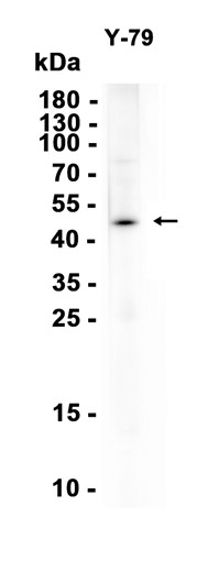 AYD16304
