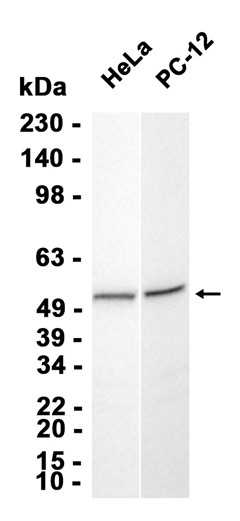AYD11379