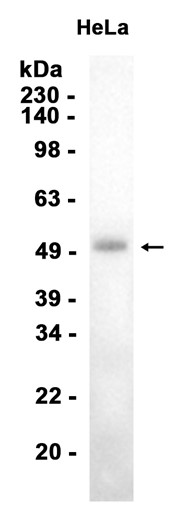 AYD15505