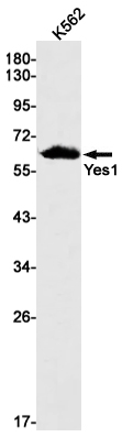 AYD14436