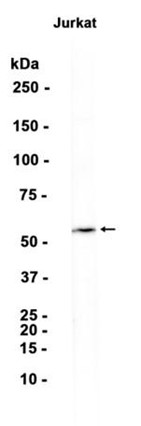 AYD14188