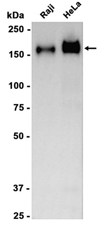 AYD15764