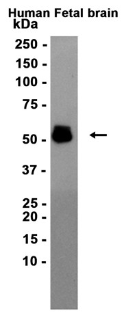 Phospho-Tau (Thr181) (YD16330) Rabbit mAb