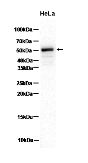 pro Caspase-1 (YD14133) Rabbit mAb