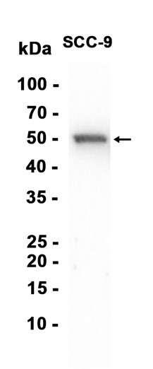 AYD14474