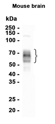 Phospho-Tau (Ser404) (YD15410) Rabbit mAb