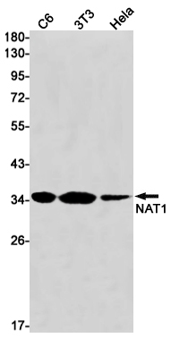 AYD14271