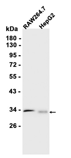 AYD14337