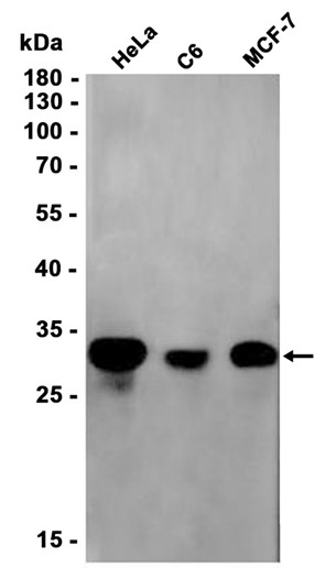 Histone H1.2 (YD20435) Rabbit mAb