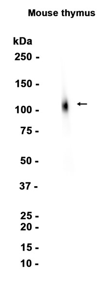 CD26 (YD16677) Rabbit mAb