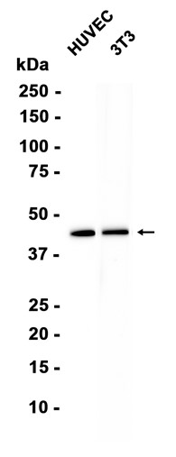 Pentraxin 3 (YD34738) Rat mAb
