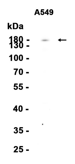 AYD13638
