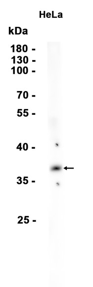 AYD15979
