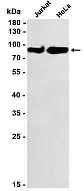 IKK alpha (YD13426) Rabbit mAb