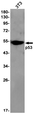 p53 (YD21005) Rabbit mAb