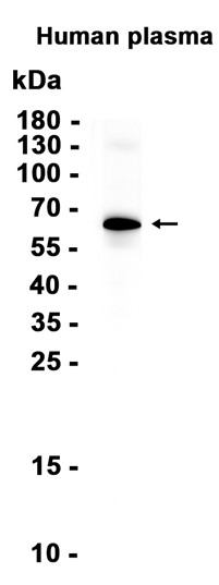 C8B (YD35773) Rabbit mAb