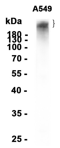 AYD13866