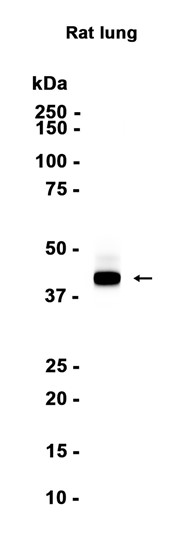 RAGE (YD12109) Rabbit mAb