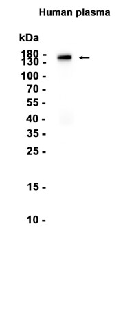 AYD12430