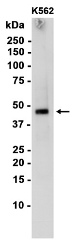 AYD14382