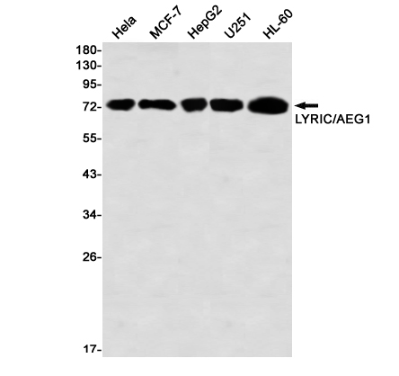 AYD14124