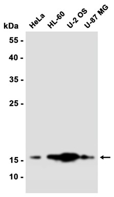 AYD14158