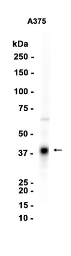 AYD14503