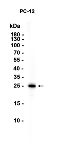 GRB2 (YD13455) Rabbit mAb