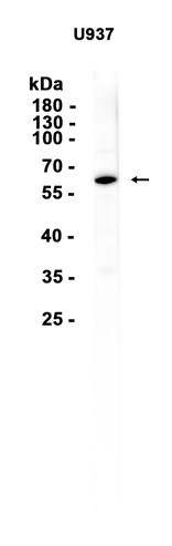 AYD15652