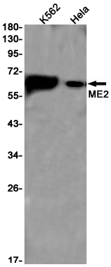 AYD11515