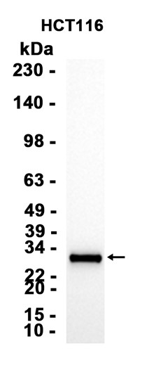 AYD14309