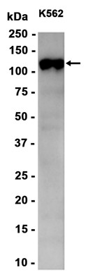 AYD15194