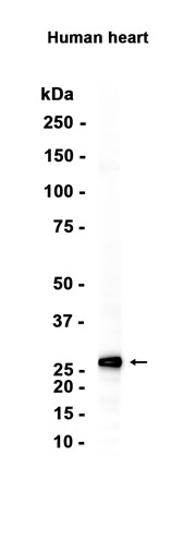 AYD14807