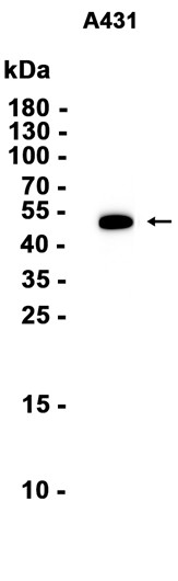 Cytokeratin 14 (YD16397) Rabbit mAb