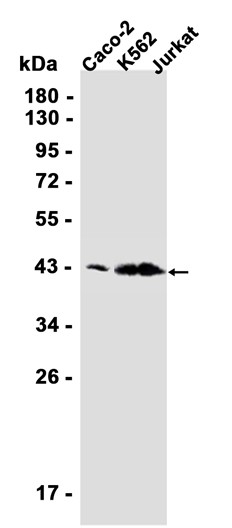 M-CSF (YD18249) Rabbit mAb