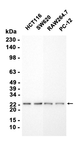 RPL10A (YD13549) Rabbit mAb