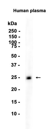 AYD12411
