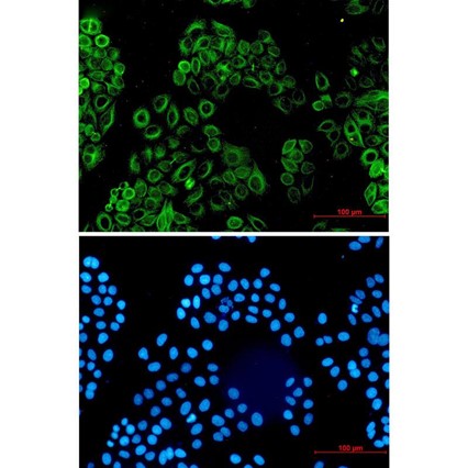 Activin A Receptor Type IB (YD13681) Rabbit mAb