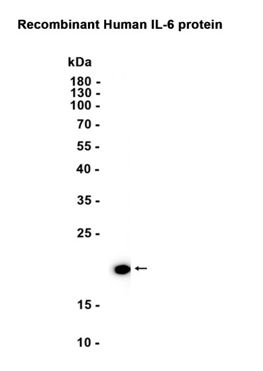 AYD14638