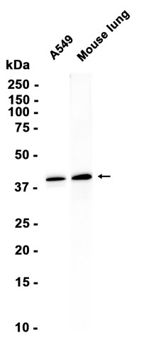 LTB4R (YD36154) Rabbit mAb