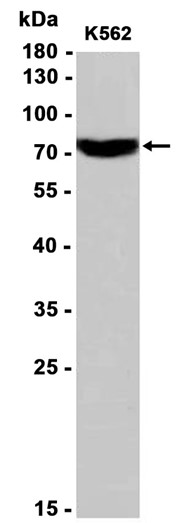 MTHFR (YD11679) Rabbit mAb