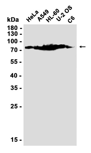 Phospho-PKC (Ser660) (YD33934) Rabbit mAb