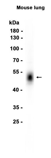 Mesothelin (YD20589) Rabbit mAb