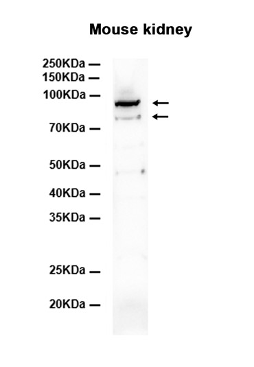 IKK alpha/beta (YD20221) Rabbit mAb