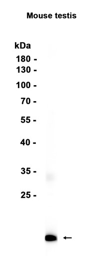 AYD11049