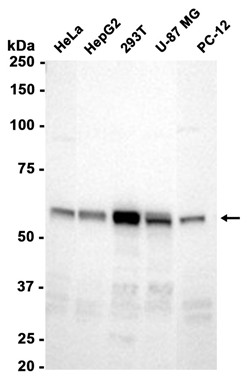 AYD14722