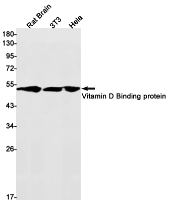 Vitamin D Binding protein (YD12882) Rabbit mAb
