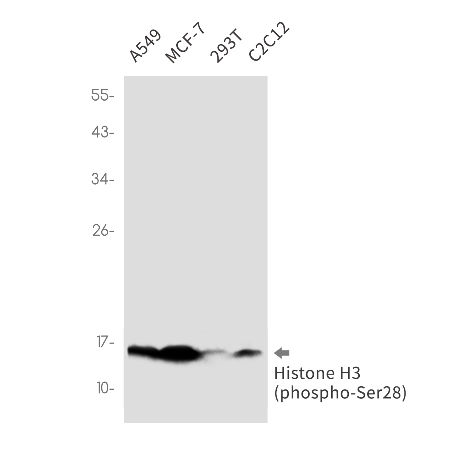 Phospho-Histone H3 (Ser28) (YD33305) Rabbit mAb